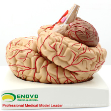 BRAIN07 (12404) Cérebro Anatômico Humano com Artérias - 9 Partes, Modelos Anatômicos&gt; Medical Brain Models